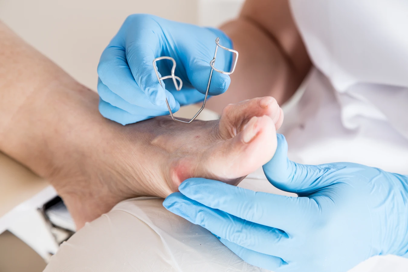 Pedicure leczniczy - czym jest i co warto wiedzieć na jego temat?