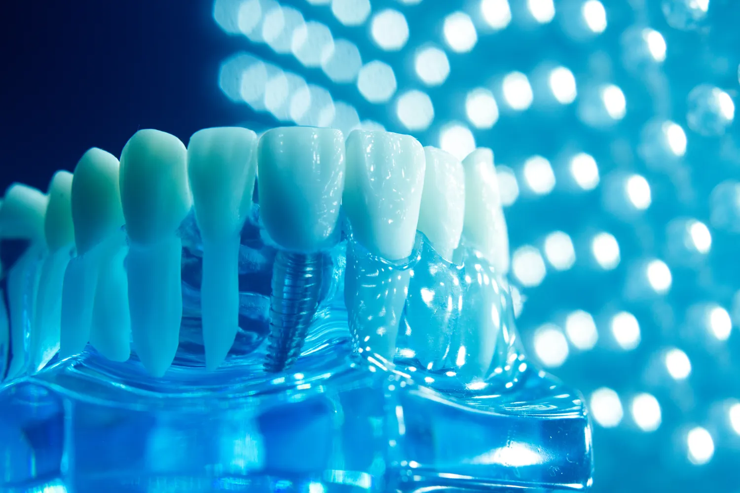 Najlepszy stomatolog Szczecin