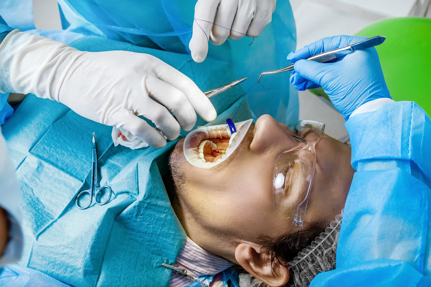 E recepta jak to zrobic?