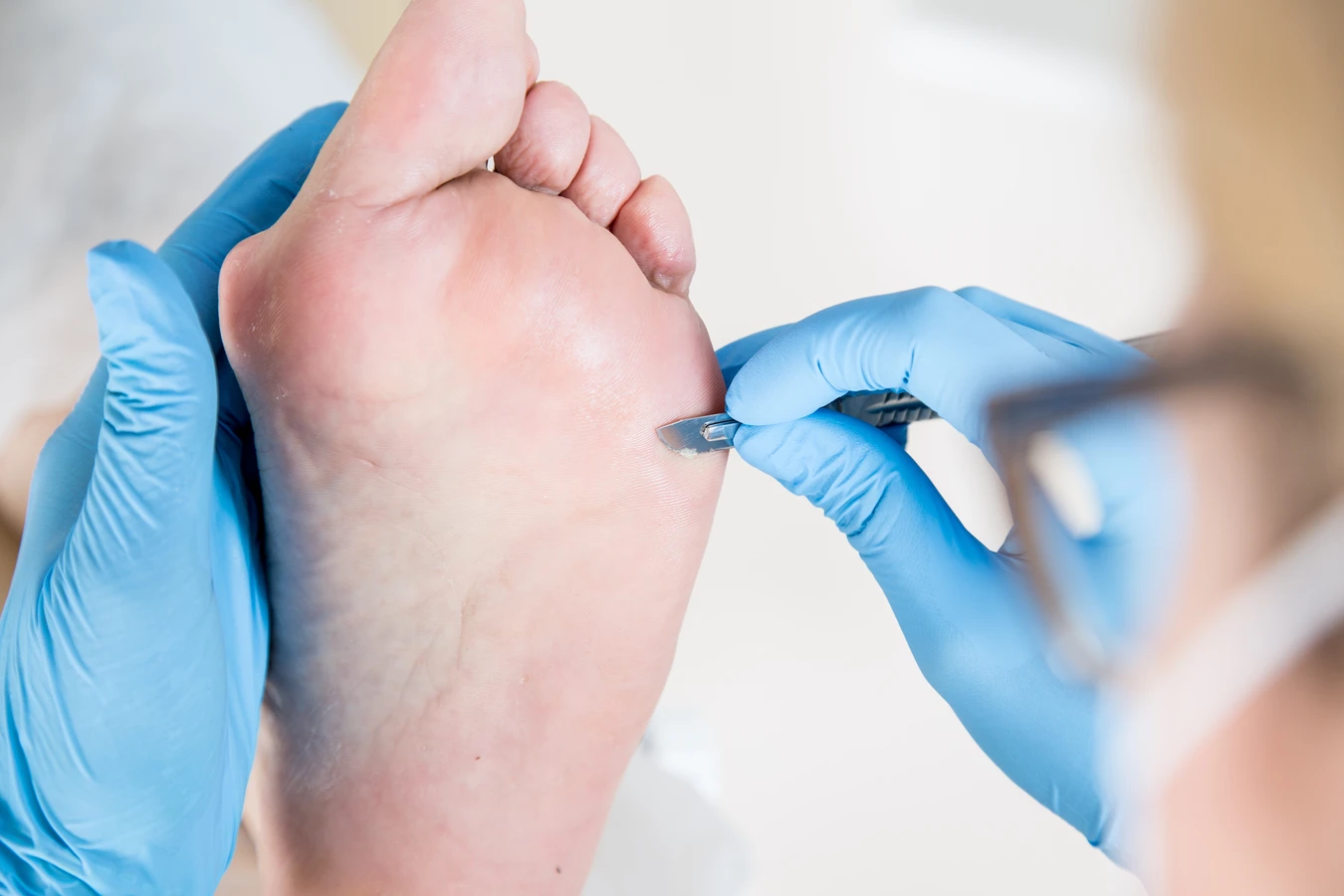 Podologia - zdrowe stopy